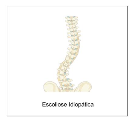 Coluna na criança - Coluna pediátrica