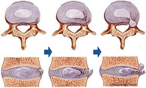 anatomia da coluna