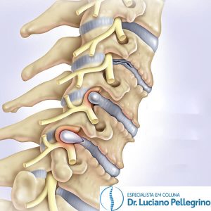 A tontura é sintoma de problema cervical? Saiba mais!