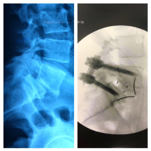 Cirurgia antes e depois