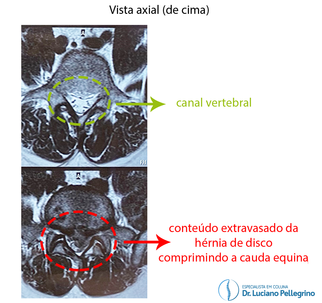 imagem de ressonância magnética vista de cima