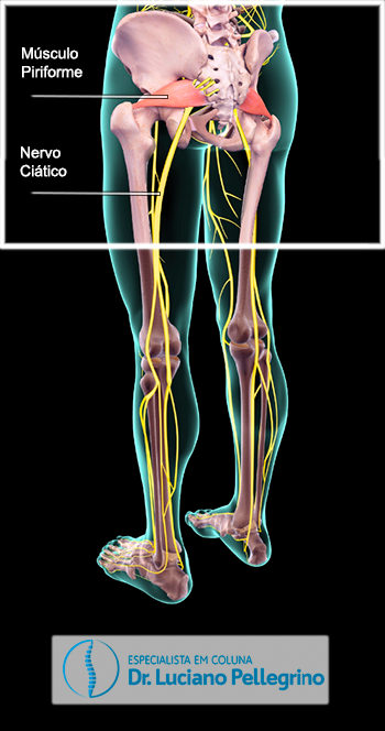 dor no gluteo nervo ciático