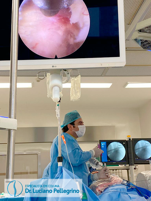 dor no glúteo e endoscopia da coluna